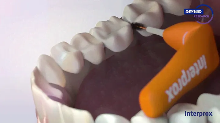 DENTAID: New Interprox® French